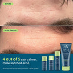 Load image into Gallery viewer, Anti-Everything Face Moisturizer
